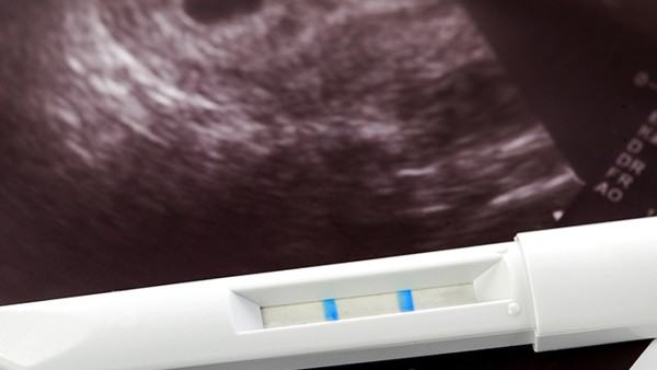 脊髓小脑共济失调如何做运动康复