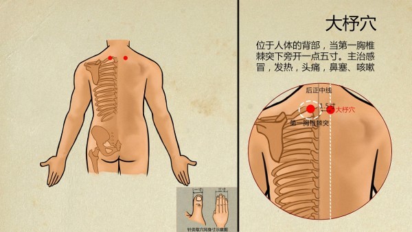 胚胎细胞瘤与其他肿瘤的区别