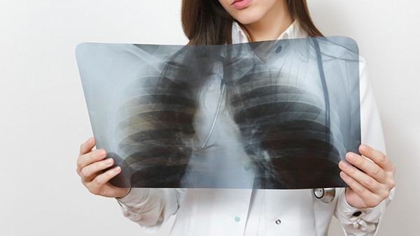 骨关节炎患者的营养补充