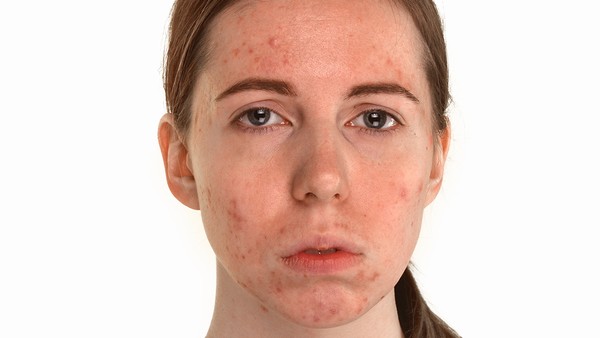癌性胸腔积液是如何导致胸膜炎的？