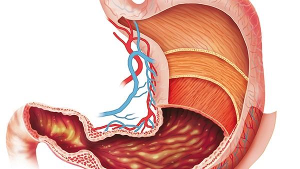 乳腺癌患者术后应该如何生活