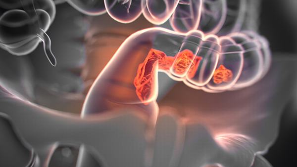 扁桃体炎的家庭护理方法