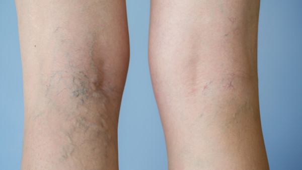 宫外孕会引起哪些不适