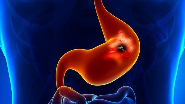 前列腺癌和前列腺炎的区别