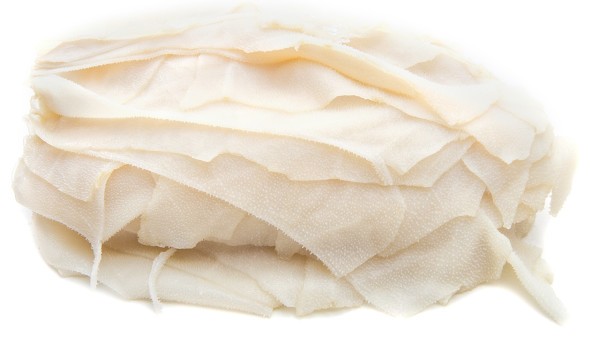 黄褐斑会在孕期加重吗