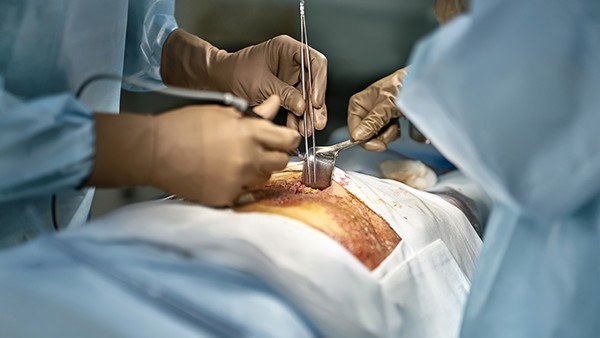 成人痤疮与青春期痤疮的不同