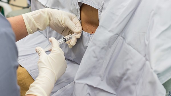 女性生殖器官结核的长期治疗方案