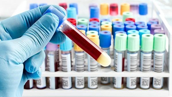 流行性感冒的药物选择