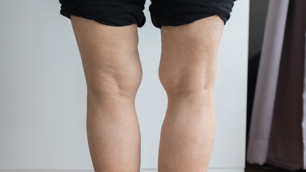 念珠菌性甲沟炎的病程管理