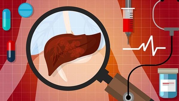 女性雄性化体征的综合治疗方案