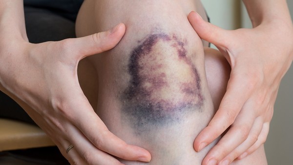 牙髓炎治疗中的常见问题