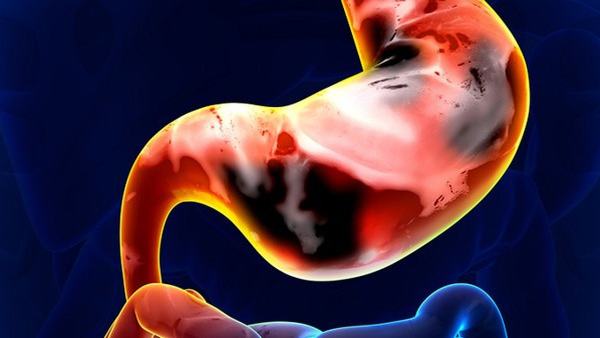 少儿多动症的检查方式