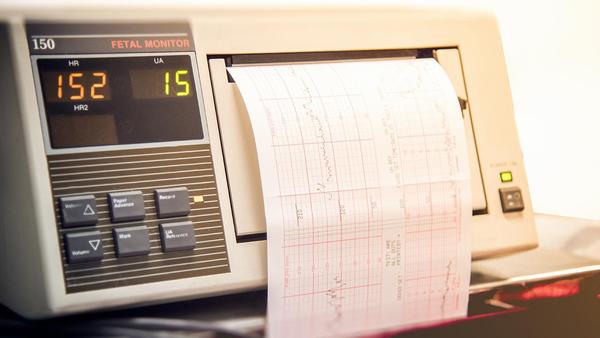 念珠菌性阴道炎治疗期间的性生活