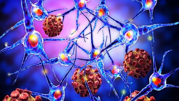 慢性咳嗽与过敏性疾病的关系