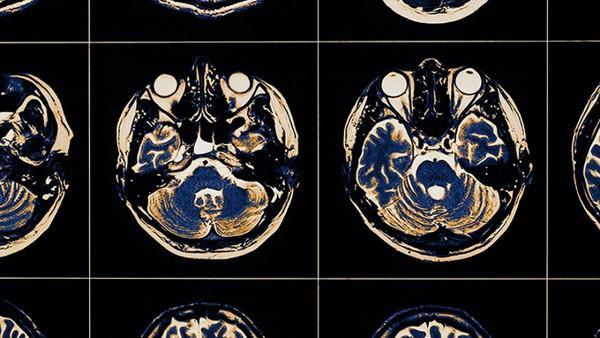 肝癌术后的护理要点