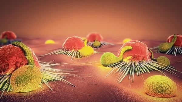 红斑狼疮的饮食注意事项