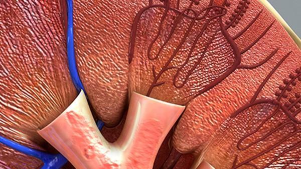 膀胱癌是否会引发乏力？