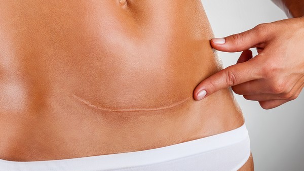 病毒性感冒会引起肌肉疼痛吗