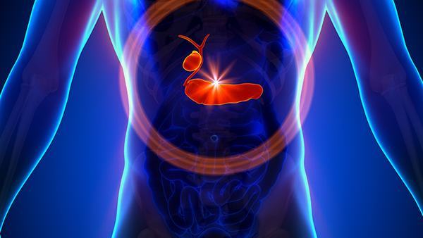 IgA肾病和肾结石的关系