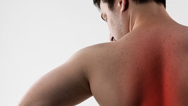 黑布拉痒疹的外用药膏