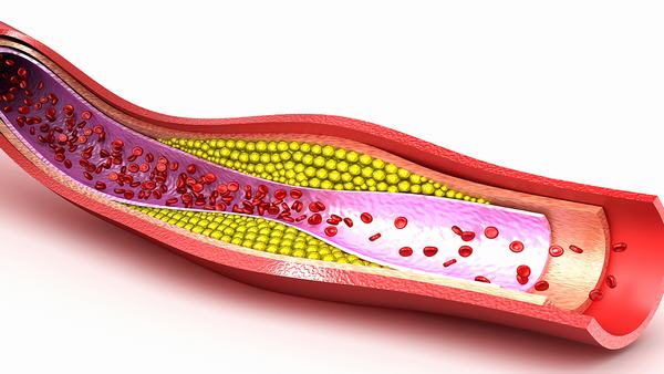 吸入性肺炎的常见治疗方法