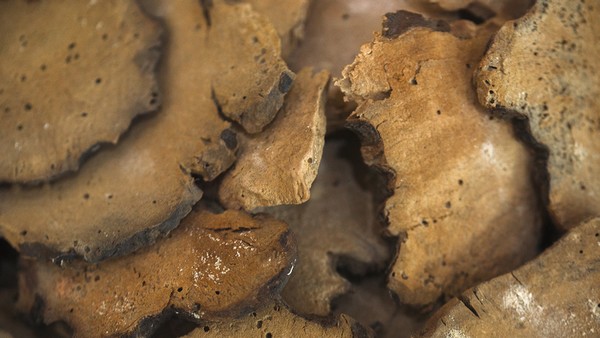 阳痿是否与高血糖有关