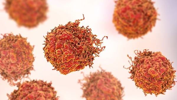 阿尔茨海默症的食欲减退