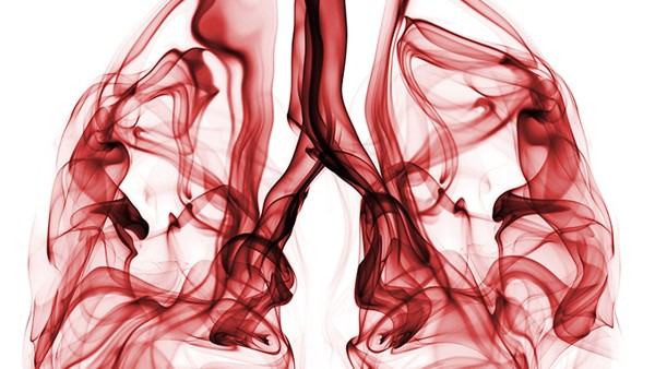 宫颈癌患者的心理疏导方法