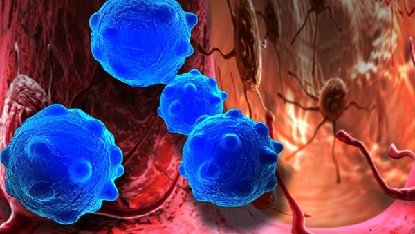 斑釉牙会影响美观吗