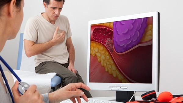 支气管扩张的预后评估