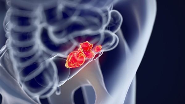 高催乳素血症的临床治疗新进展