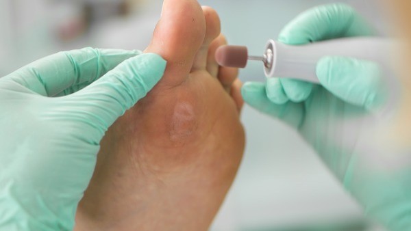 子宫内膜癌晚期的症状