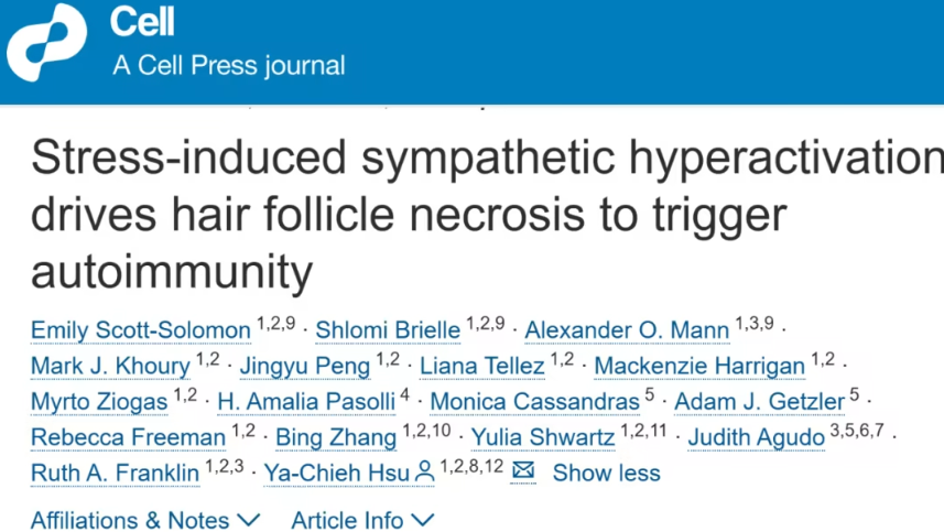 哈佛大学发现压力可诱发毛囊坏死并触发自身免疫反应