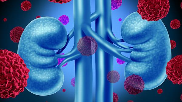 自身免疫性肝炎的生活习惯改变