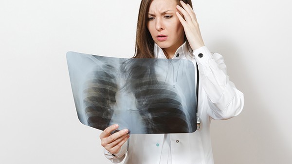 脊髓小脑共济失调的临床预后