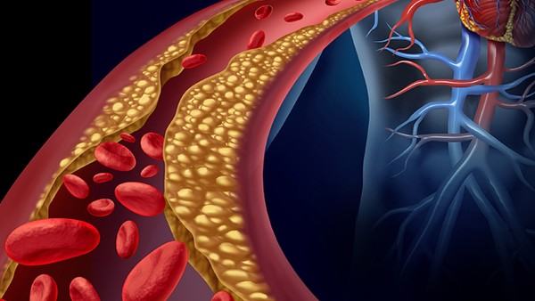 白血病患者的家庭护理要点