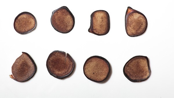 骨髓纤维化的症状缓解药物