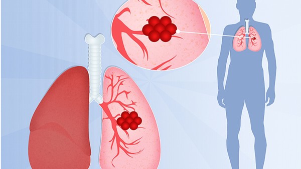 宫颈疫苗接种后能否喝酒