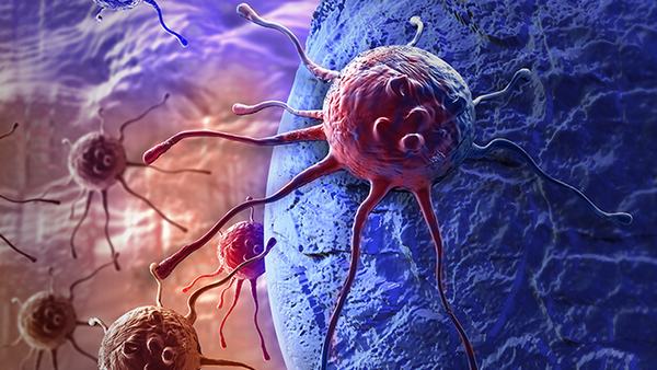 胶质瘤的治疗需要多长时间