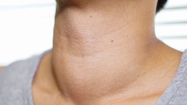 红斑痤疮与激素水平的关系